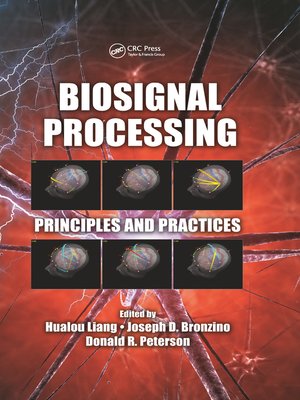 cover image of Biosignal Processing